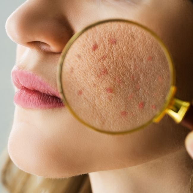 Especialidades dermatología