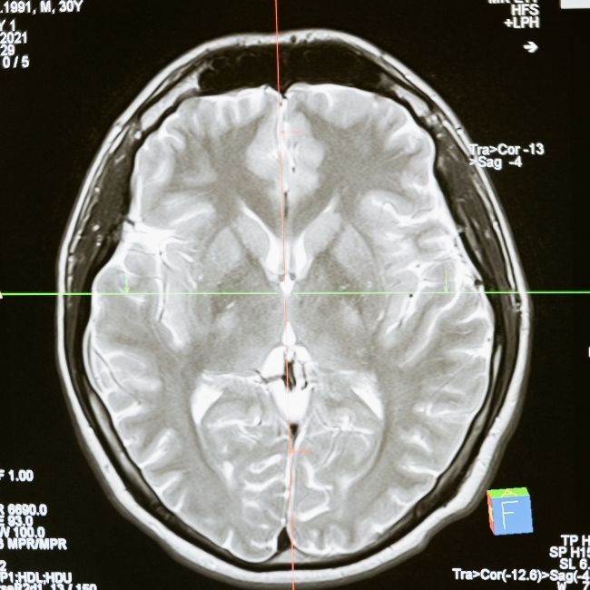 Especialidades neurología
